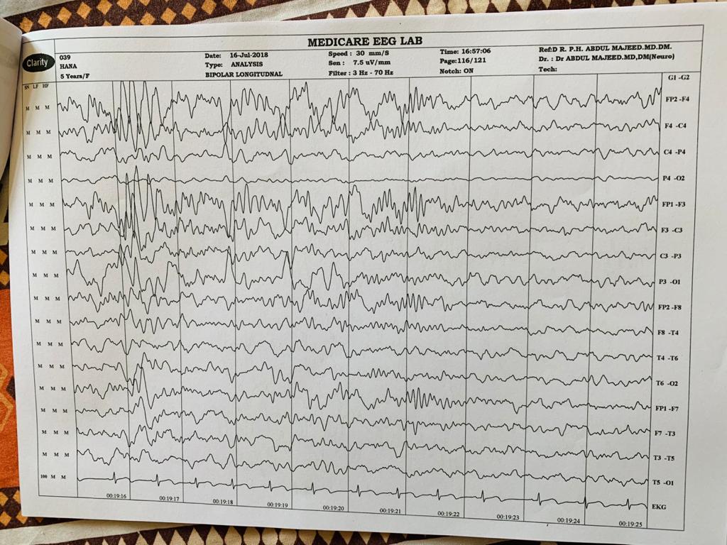 Patient Story